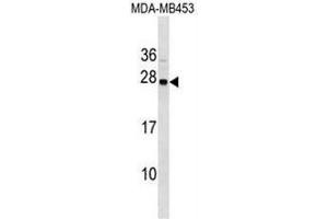 SYNGR1 Antibody (C-term) western blot analysis in MDA-MB453 cell line lysates (35µg/lane).