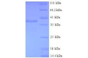 SDS-PAGE (SDS) image for Glutathione S-Transferase pi 1 (GSTP1) (AA 2-210) protein (His-SUMO Tag) (ABIN5709619)