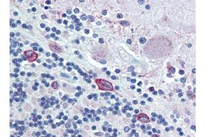 Brain, cerebellum, Human: Formalin-Fixed, Paraffin-Embedded (FFPE) (PDIA4 抗体  (AA 623-638))