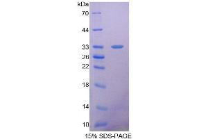 SDS-PAGE (SDS) image for Succinate Dehydrogenase Complex, Subunit A, Flavoprotein (Fp) (SDHA) (AA 4-300) protein (His tag) (ABIN6237607)