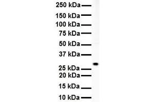 WB Suggested Anti-RNF2 antibody Titration: 1 ug/mL Sample Type: Human Daudi (RNF2 抗体  (Middle Region))