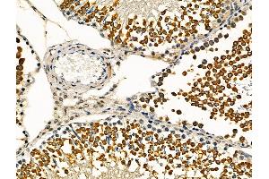 ABIN6264808 and ABIN6276442 at 1/100 staining Rat testis tissue by IHC-P. (RPA1 抗体  (Internal Region))