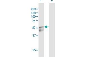 Western Blot analysis of GAL3ST1 expression in transfected 293T cell line by GAL3ST1 MaxPab polyclonal antibody. (GAL3ST1 抗体  (AA 1-423))