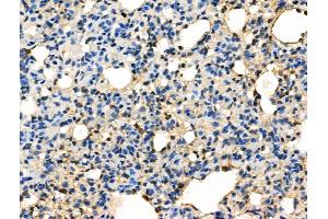 Phospho-Caspase 8 (Tyr380) Antibody at 1/100 staining Rat lung tissue by IHC-P.