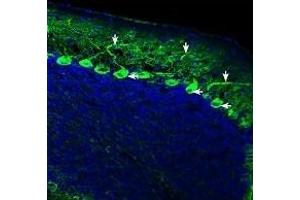 Immunohistochemistry (IHC) image for anti-IQ Motif Containing GTPase Activating Protein 1 (IQGAP1) (AA 793-808), (Intracellular) antibody (ABIN7043292)