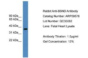 WB Suggested Anti-BSND  Antibody Titration: 0.