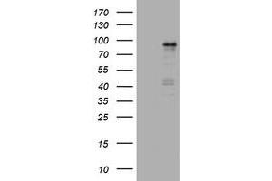 Image no. 1 for anti-Nibrin (NBN) (AA 461-754) antibody (ABIN1491541) (Nibrin 抗体  (AA 461-754))