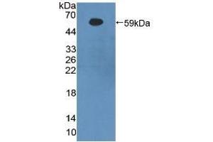 Detection of Recombinant bACE1, Human using Polyclonal Antibody to Beta-Site APP Cleaving Enzyme 1 (bACE1) (BACE1 抗体  (AA 170-428))