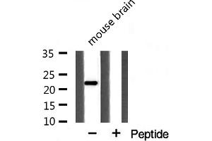 Western blot analysis of extracts from mouse Brian cells using PPIF antibody. (PPIF 抗体  (Internal Region))