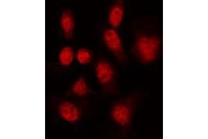 Immunofluorescence (fixed cells) (IF/ICC) image for anti-GATA Binding Protein 1 (Globin Transcription Factor 1) (GATA1) (pSer142) antibody (ABIN6254982)