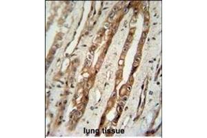 SERPING1 Antibody (Center) (ABIN390620 and ABIN2840928) immunohistochemistry analysis in formalin fixed and paraffin embedded human lung tissue followed by peroxidase conjugation of the secondary antibody and DAB staining.