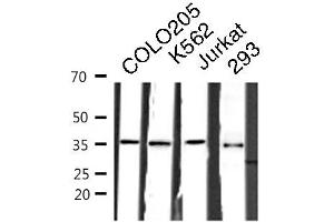 Western blot analysis of COLO205/K562/JURKAT/293 cell lysates using RNF113B antibody. (RNF113B 抗体  (Internal Region))