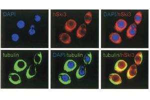 Immunofluorescence Microscopy of anti-SKI3 antibody Immunofluorescence Microscopy results of Rabbit anti-SKI3 antibody. (TTC37 抗体)
