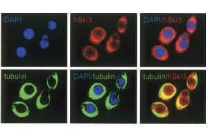 Immunofluorescence Microscopy of anti-SKI3 antibody Immunofluorescence Microscopy results of Rabbit anti-SKI3 antibody. (TTC37 抗体)