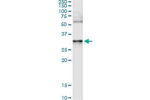 Immunoprecipitation of ANXA3 transfected lysate using anti-ANXA3 monoclonal antibody and Protein A Magnetic Bead , and immunoblotted with ANXA3 MaxPab rabbit polyclonal antibody. (Annexin A3 抗体  (AA 1-323))