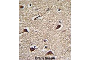 Immunohistochemistry (IHC) image for anti-6-phosphogluconolactonase (PGLS) antibody (ABIN3001729) (PGLS 抗体)