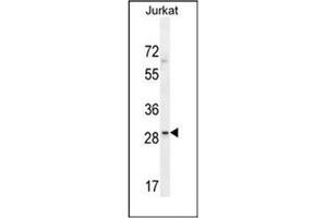 Western blot analysis of LRRC25 Antibody (C-term) in Jurkat cell line lysates (35ug/lane).