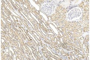 Immunohistochemical analysis of paraffin-embedded Human kidney section using Pink1 am2250b. (BBS4 抗体  (AA 1-240))