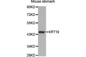 Western Blotting (WB) image for anti-Keratin 19 (KRT19) (AA 241-400) antibody (ABIN3020779) (Cytokeratin 19 抗体  (AA 241-400))