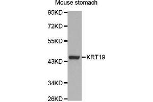 Western Blotting (WB) image for anti-Keratin 19 (KRT19) (AA 241-400) antibody (ABIN3020779)