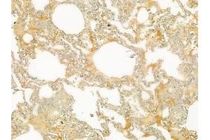 ABIN6265013 and ABIN6279108 at 1/100 staining human normal lung tissue by IHC-P.