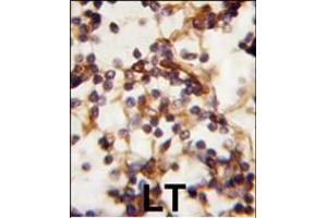 Immunohistochemistry (Paraffin-embedded Sections) (IHC (p)) image for anti-RPTOR Independent Companion of mTOR, Complex 2 (RICTOR) (AA 252-281), (N-Term) antibody (ABIN391384)