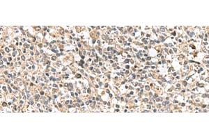 Immunohistochemistry (Paraffin-embedded Sections) (IHC (p)) image for anti-Protein tyrosine Phosphatase, Receptor Type, S (PTPRS) antibody (ABIN7247399)