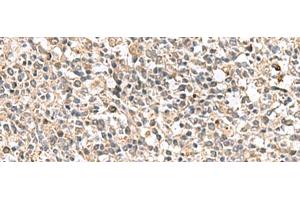 Immunohistochemistry of paraffin-embedded Human tonsil tissue using PTPRS Polyclonal Antibody at dilution of 1:110(x200) (PTPRS 抗体)