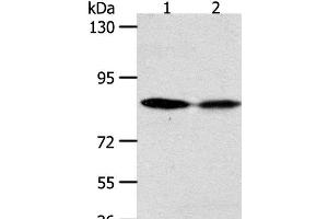 Western Blot analysis of Hela and SKOV3 cell using ADAM11 Polyclonal Antibody at dilution of 1:500 (ADAM11 抗体)