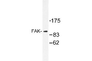 Image no. 1 for anti-PTK2 Protein tyrosine Kinase 2 (PTK2) antibody (ABIN272099) (FAK 抗体)