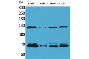 Western Blotting (WB) image for anti-K-Cadherin (CDH6) (Internal Region) antibody (ABIN3187664) (CDH6 抗体  (Internal Region))