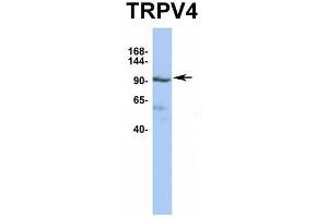 Western Blotting (WB) image for anti-Transient Receptor Potential Cation Channel, Subfamily V, Member 4 (TRPV4) (Middle Region) antibody (ABIN2776284)