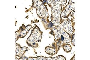 Immunohistochemistry (IHC) image for anti-Platelet Derived Growth Factor Subunit B (PDGFB) (AA 20-241) antibody (ABIN3021689)