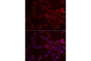 Immunofluorescence analysis of A549 cells using GATM antibody. (GATM 抗体)