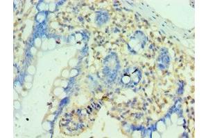 Immunohistochemistry of paraffin-embedded human small intestine tissue using ABIN7162868 at dilution of 1:100 (PTRH2 抗体  (AA 40-179))