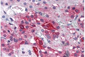 Human Adrenal (formalin-fixed, paraffin-embedded) stained with GRIK1 antibody ABIN343898 at 5 ug/ml followed by biotinylated goat anti-rabbit IgG secondary antibody ABIN481713, alkaline phosphatase-streptavidin and chromogen. (GRIK1 抗体  (Internal Region))