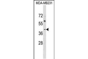 Western blot analysis in MDA-MB231 cell line lysates (35ug/lane). (ABO 抗体  (N-Term))