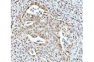 IHC analysis of 53BP1/TP53BP1 using anti-53BP1/TP53BP1 antibody (ABIN7599869).
