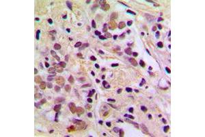 Immunohistochemistry (IHC) image for anti-Apoptosis Antagonizing Transcription Factor (AATF) (N-Term) antibody (ABIN7298044)
