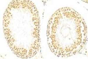 Immunohistochemistry analysis of paraffin-embedded rat testis using,SIN1 (ABIN7074669) at dilution of 1: 500 (MAPKAP1 抗体)