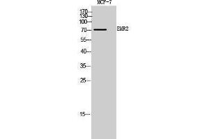 Western Blotting (WB) image for anti-Egf-Like Module Containing, Mucin-Like, Hormone Receptor-Like 2 (EMR2) (Internal Region) antibody (ABIN3188026) (EMR2 抗体  (Internal Region))