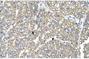 Immunohistochemistry (IHC) image for anti-ATPase, Na+/K+ Transporting, beta 1 Polypeptide (ATP1B1) (Middle Region) antibody (ABIN2781852)