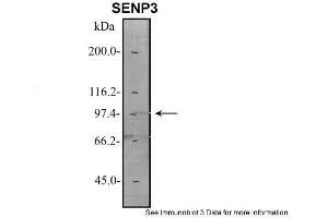 Sample Type: 1. (SENP3 抗体  (N-Term))