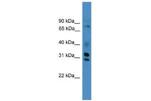 WB Suggested Anti-GIPC3 Antibody Titration:  0.