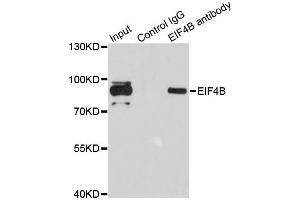 Immunoprecipitation analysis of 200 μg extracts of 293T cells using 1 μg EIF4B antibody (ABIN5973134). (EIF4B 抗体)