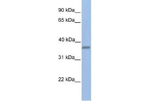 WB Suggested Anti-EMID1 Antibody Titration:  0. (EMID1 抗体  (C-Term))
