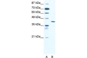 WB Suggested Anti-ZNF621 Antibody Titration:  2. (ZNF621 抗体  (Middle Region))