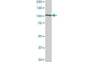 AARS MaxPab polyclonal antibody. (AARS 抗体  (AA 1-968))