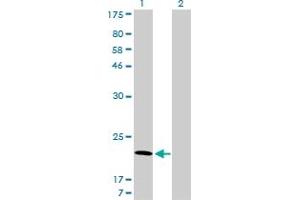 Western Blotting (WB) image for anti-ADP-Ribosylation Factor 5 (ARF5) (AA 81-180) antibody (ABIN559926)