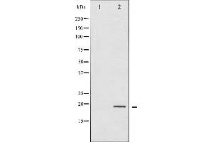 Western Blotting (WB) image for anti-Eukaryotic Translation Initiation Factor 4E Binding Protein 1 (EIF4EBP1) (pThr36) antibody (ABIN6256550)